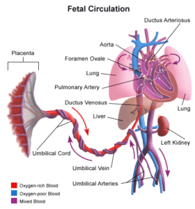 Persistent Pulmonary Hypertension of the Newborn NJ Lawyer