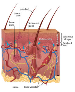 NJ Skin Cancer Misdiagnosis Lawyers