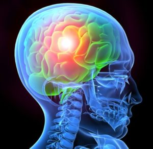 Need a lawyer for traumatic brain injury case NJ