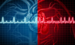 Atrial Fibrillation Lawsuit Help NJ