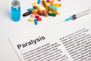 Paralysis from Medical Malpractice NJ Lawyer Help