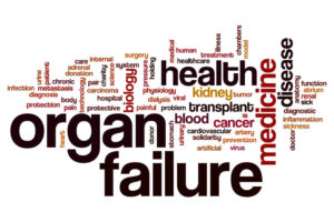 Organ Failure Malpractice Lawyers New Jersey