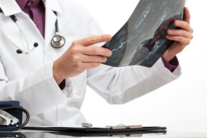 Malpractice Lawsuits Against Oncologists NJ