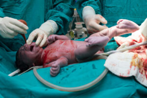 Differences Between Maternal and Newborn Birth Injuries